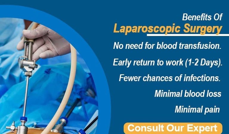 Laparoscopic Myomectomy Cost In India