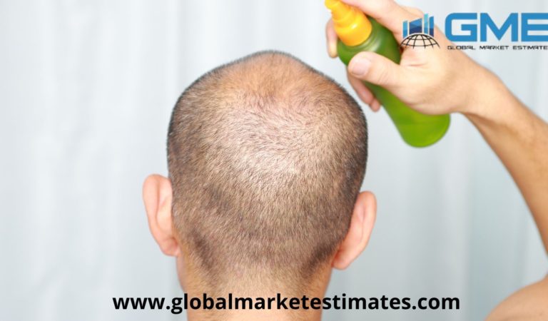 Global Hair Restoration Market Research Report