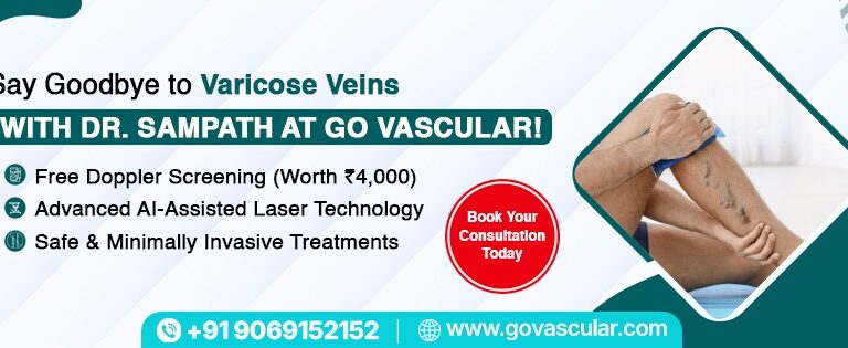 Best Varicose Vein Hospital in Hyderabad